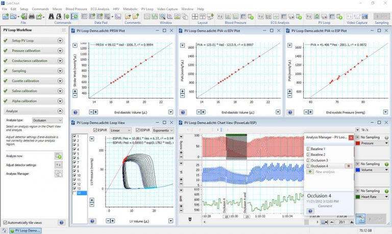 Pressure Volume Loops – AdvanceTech Private Limited